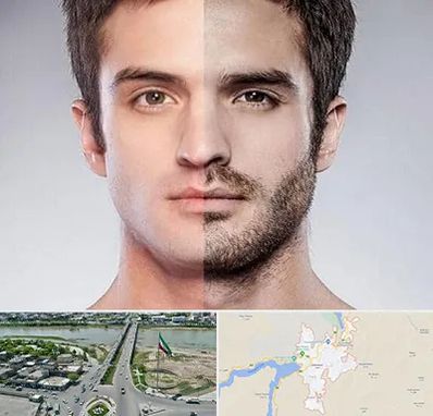 کاشت ریش و سبیل در میاندوآب