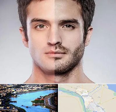 کاشت ریش و سبیل در خرمشهر