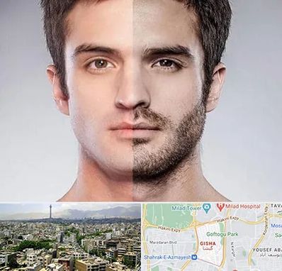 کاشت ریش و سبیل در گیشا