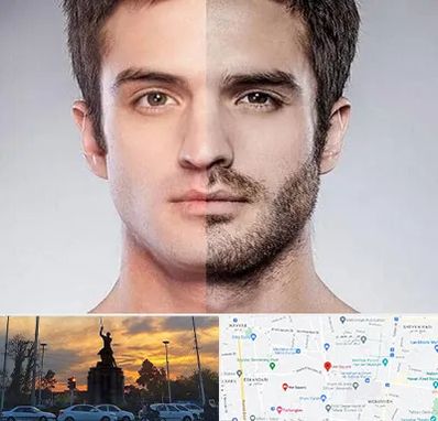 کاشت ریش و سبیل در میدان حر