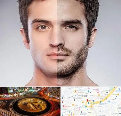 کاشت ریش و سبیل در میدان ولیعصر