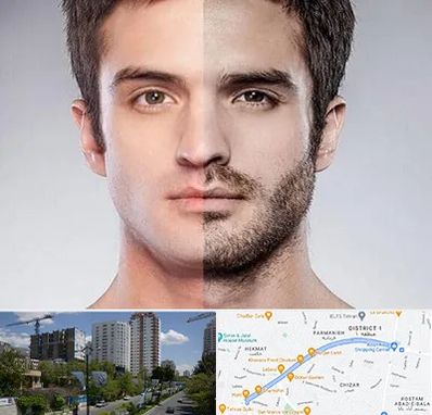 کاشت ریش و سبیل در اندرزگو