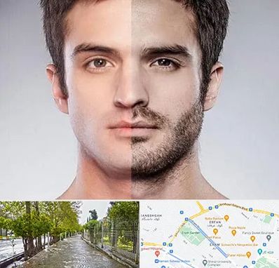 کاشت ریش و سبیل در خیابان ارم شیراز