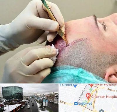 کلینیک کاشت مو در اقدسیه