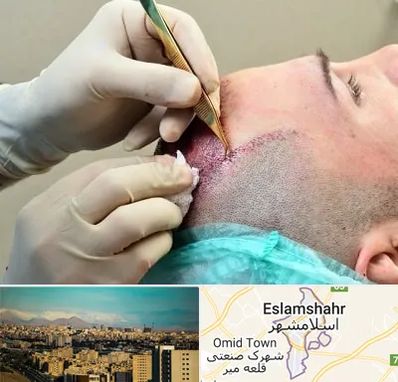 کلینیک کاشت مو در اسلامشهر