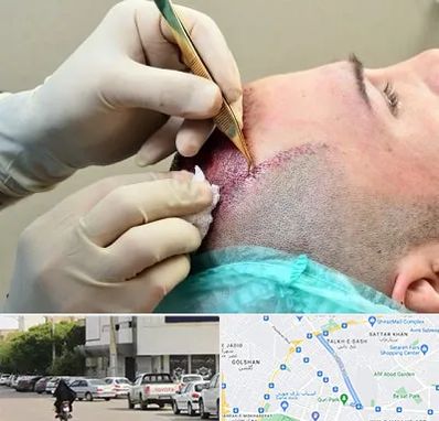 کلینیک کاشت مو در قدوسی شرقی شیراز