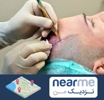 کلینیک کاشت مو در نزدیک من