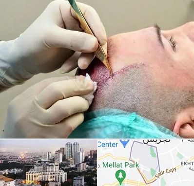 کلینیک کاشت مو در الهیه