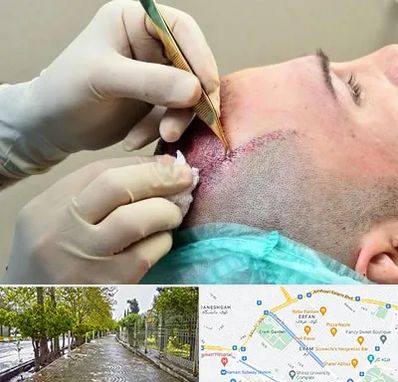 کلینیک کاشت مو در خیابان ارم شیراز