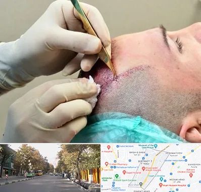 کلینیک کاشت مو در شریعتی