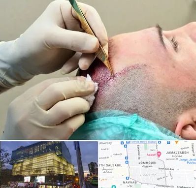 کلینیک کاشت مو در جمهوری