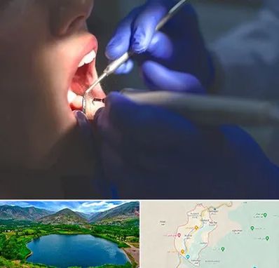 عصب کشی در رودبار