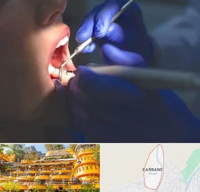 عصب کشی در دربند