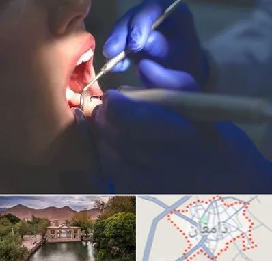 عصب کشی در دامغان