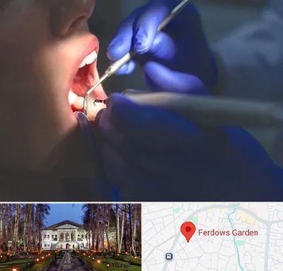 عصب کشی در باغ فردوس