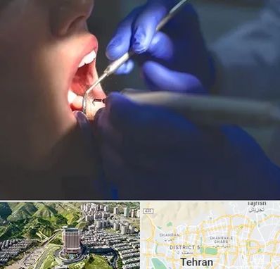 عصب کشی در شمال تهران