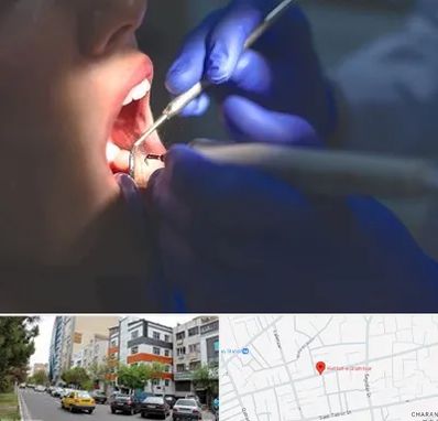 عصب کشی در هفده شهریور تبریز