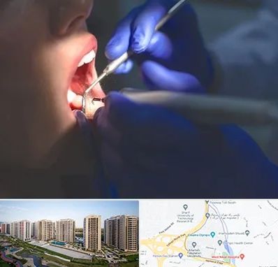 عصب کشی در المپیک