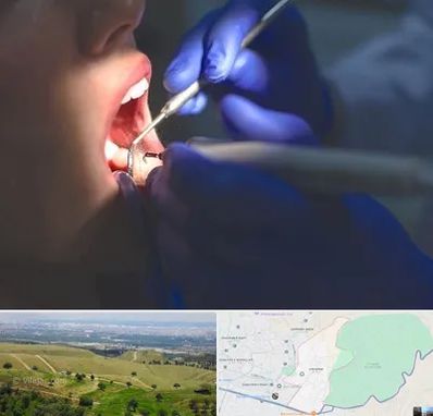 عصب کشی در سوهانک