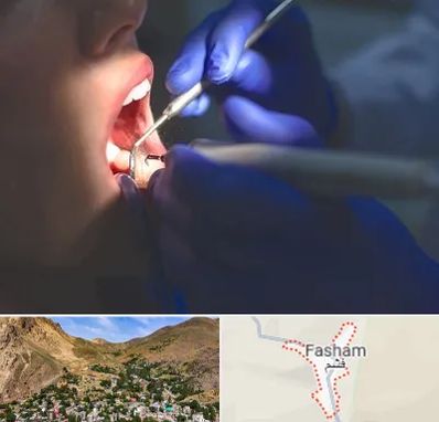 عصب کشی در فشم