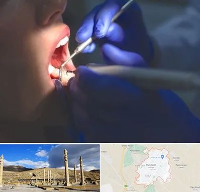 عصب کشی در مرودشت