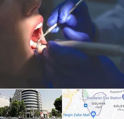 عصب کشی در قلهک