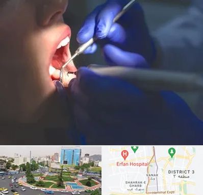 عصب کشی در ونک 