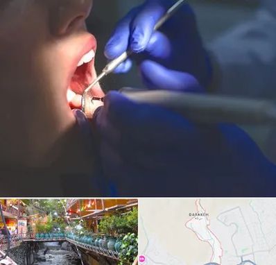 عصب کشی در درکه