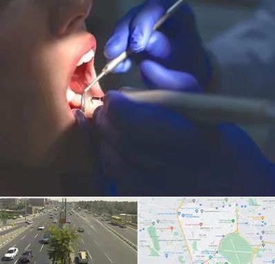 عصب کشی در منطقه 17 تهران