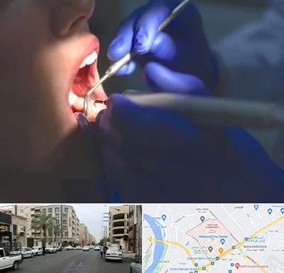 عصب کشی در زیتون کارمندی اهواز