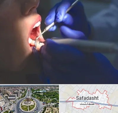 عصب کشی در صفادشت