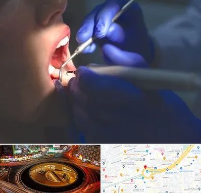 عصب کشی در میدان ولیعصر