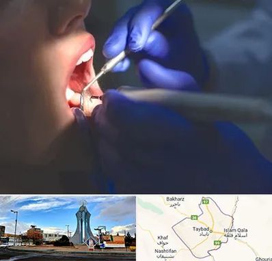 عصب کشی در تایباد