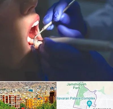 عصب کشی در نیاوران 