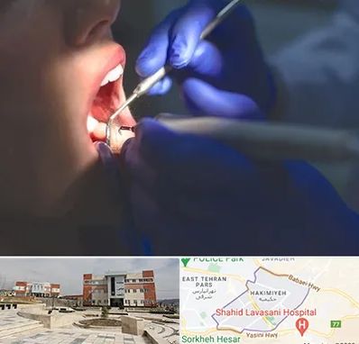 عصب کشی در حکیمیه