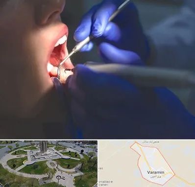 عصب کشی در ورامین