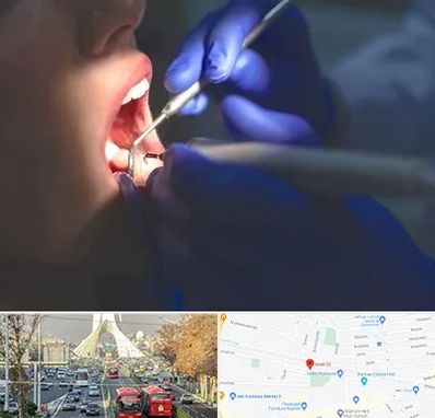 عصب کشی در خیابان آزادی