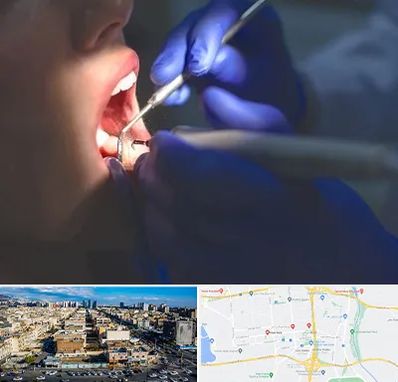 عصب کشی در شهرک راه آهن