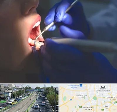 عصب کشی در جنوب تهران