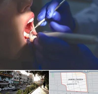 عصب کشی در خیابان جمالزاده