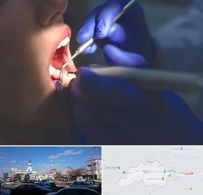 عصب کشی در ماهدشت کرج