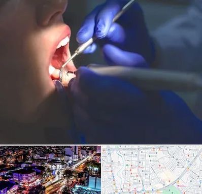 عصب کشی در منظریه رشت