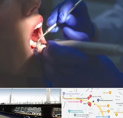 عصب کشی در پارک وی