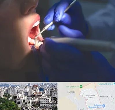 عصب کشی در ولنجک 