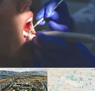 عصب کشی در منطقه 21 تهران