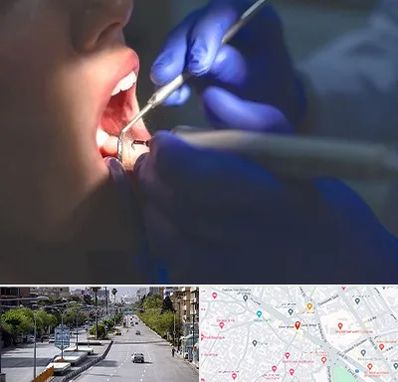 عصب کشی در خیابان زند شیراز