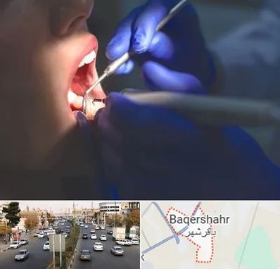 عصب کشی در باقرشهر