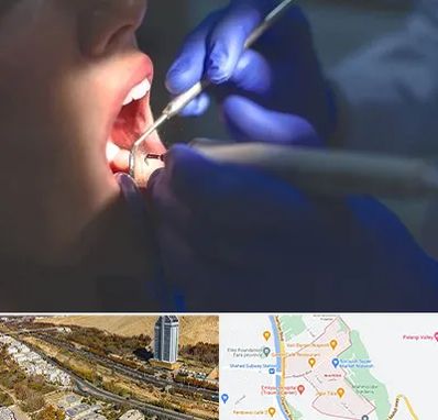 عصب کشی در خیابان نیایش شیراز