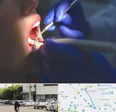 عصب کشی در قدوسی شرقی شیراز