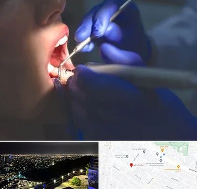 عصب کشی در هفت تیر مشهد